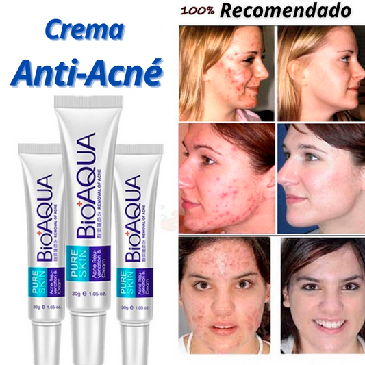 Crema Anti Acné "Bioaqua" OFERTA 2X1