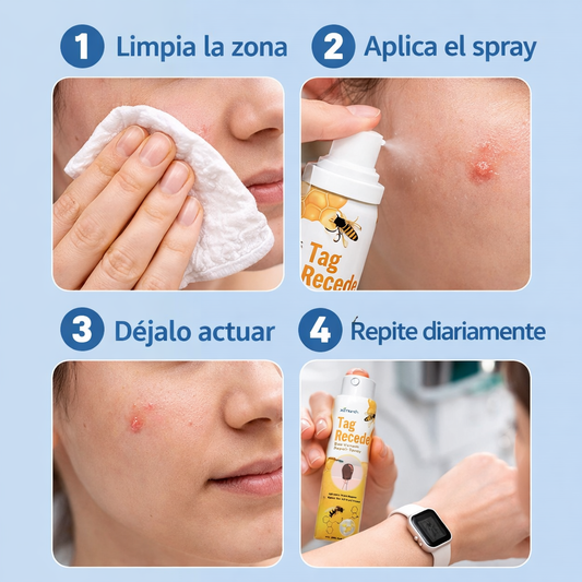 Spray Veneno de Abeja Reparador de Piel y Verrugas