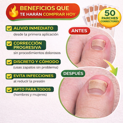 Parche Corrector de Uñas (50 Unidades)