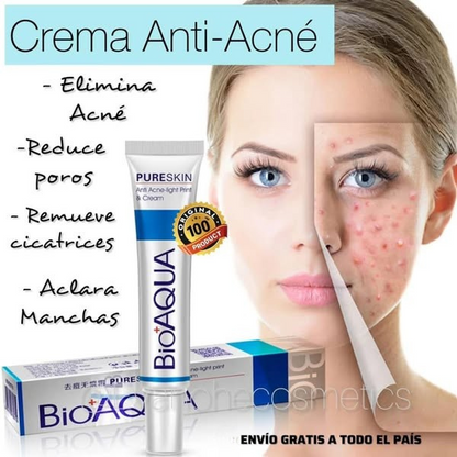 Crema Anti Acné "Bioaqua" OFERTA 2X1