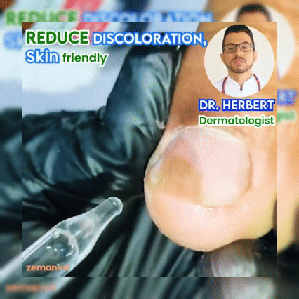 Aceite Reparador Rápido Uñas Pies
