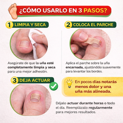 Parche Corrector de Uñas (50 Unidades)