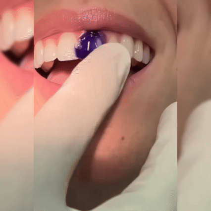 Sonrisa Púrpura Brillante